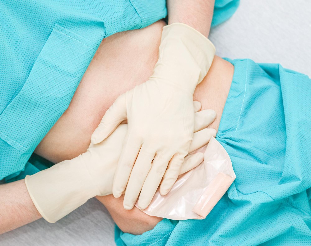 Quando a Abdominoplastia em Âncora é Indicada? Saiba Mais! 2 Quando a Abdominoplastia em Ancora e Indicada 2