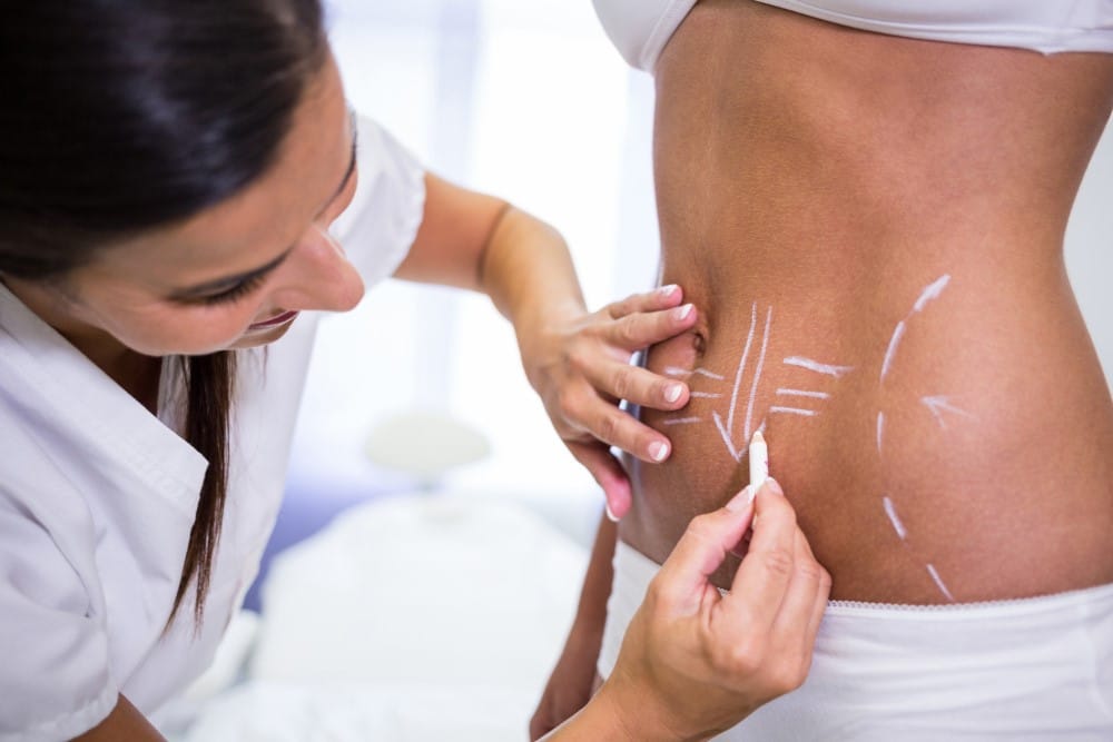 Cirurgia Plastica e Aceitacao Corporal